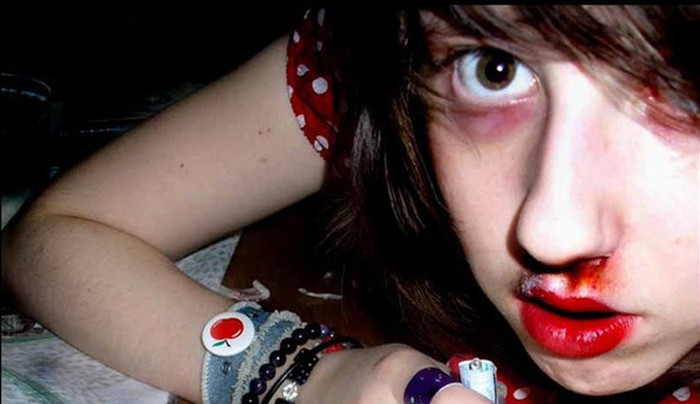 Với những người nghiện, nếu “đập đá” bằng cách hít thuốc qua đường mũi thì họ thường hay bị chảy máu mũi.