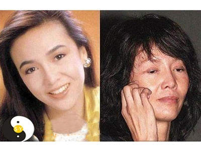 Một cô gái trở thành bà già sau ca giải phẫu thẩm mỹ. Ảnh: Easy.net Một cô gái trở thành bà già sau ca giải phẫu thẩm mỹ. Ảnh: Easy.net