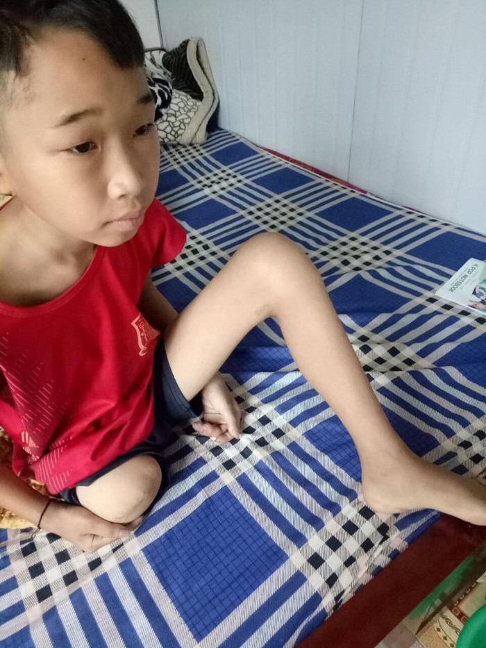 E Lò Văn Dương trong quá trình điều trị tại bệnh viện. E Lò Văn Dương trong quá trình điều trị tại bệnh viện.