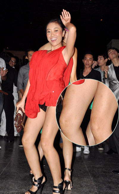 Ca sỹ Đoan Trang từng gây sốc với bộ đồ không chỉ khoe nội y mà còn lộ rõ điểm yếu đôi chân ngắn, thô và loáng thoáng "hoa văn". Ca sỹ Đoan Trang từng gây sốc với bộ đồ không chỉ khoe nội y mà còn lộ rõ điểm yếu đôi chân ngắn, thô và loáng thoáng "hoa văn".