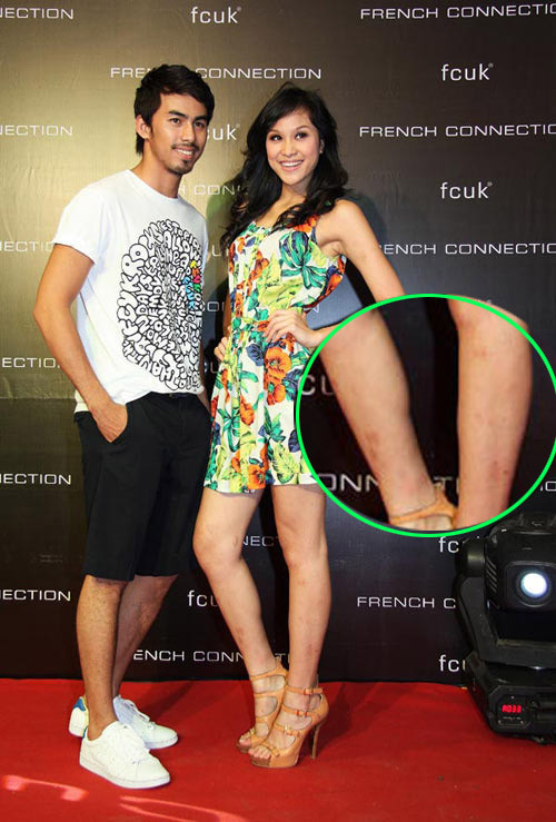 Phương Mai liên tục bị soi đôi chân xấu xí. Phương Mai liên tục bị soi đôi chân xấu xí.