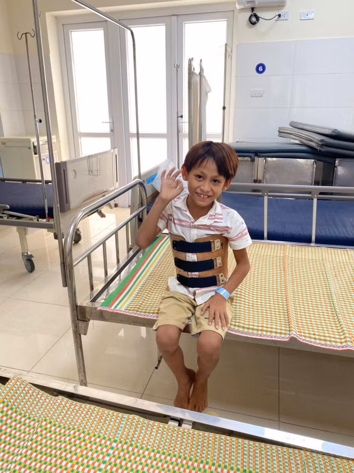 Nụ cười của Vàng Nhù Xa khi được phẫu thuật cột sống lưng thành công. Ảnh cô giáo Bùi Thị Minh Khuyên