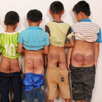 Hàng loạt học sinh là nạn nhân của bạo lực học đường. Ảnh minh họa từ internet