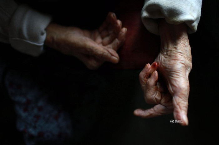 Di chứng bại liệt sau lần bị ngã khiến bàn tay bà cụ co quắp. Người mẹ anh Vũ vẫn thường nói đùa, bàn tay bà cụ là "long trảo thủ", cầm nắm rất khó khăn. Di chứng bại liệt sau lần bị ngã khiến bàn tay bà cụ co quắp. Người mẹ anh Vũ vẫn thường nói đùa, bàn tay bà cụ là "long trảo thủ", cầm nắm rất khó khăn.