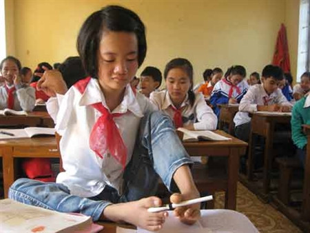 Nhưng rồi, việc tập luyện và những nỗi vất vả trong cuộc sống, cùng với di chứng của chất độc dioxin đã khiến em bị vẹo cột sống. Đôi chân thần kỳ của em giờ cũng bên ngắn, bên dài. Bàn chân trái cầm bút viết đã dài hơn bàn chân phải. 15 tuổi, nhưng em chỉ cao chưa đầy 1,4m và nặng chỉ 26kg. >>Vẻ đẹp mặn mà của hotgirl Midu >>Những gương mặt cực hot tại Miss Việt Đức >>Những nữ sinh tỏa sáng tại Hoa hậu Phụ nữ Việt Nam qua ảnh >>So độ siêu kute của những nữ sinh đình đám nhất Thủ đô >>Phát sốt vì 4 nữ giáo viên xinh đẹp >>Hoa khôi ĐH Thương Mại 2012 duyên dáng áo dài >>Những hotgirl xinh đẹp làm điên đảo cư dân mạng Những nữ sinh đẹp mê hồn giữa đầm sen Nhưng rồi, việc tập luyện và những nỗi vất vả trong cuộc sống, cùng với di chứng của chất độc dioxin đã khiến em bị vẹo cột sống. Đôi chân thần kỳ của em giờ cũng bên ngắn, bên dài. Bàn chân trái cầm bút viết đã dài hơn bàn chân phải. 15 tuổi, nhưng em chỉ cao chưa đầy 1,4m và nặng chỉ 26kg. >>Vẻ đẹp mặn mà của hotgirl Midu >>Những gương mặt cực hot tại Miss Việt Đức >>Những nữ sinh tỏa sáng tại Hoa hậu Phụ nữ Việt Nam qua ảnh >>So độ siêu kute của những nữ sinh đình đám nhất Thủ đô >>Phát sốt vì 4 nữ giáo viên xinh đẹp >>Hoa khôi ĐH Thương Mại 2012 duyên dáng áo dài >>Những hotgirl xinh đẹp làm điên đảo cư dân mạng Những nữ sinh đẹp mê hồn giữa đầm sen