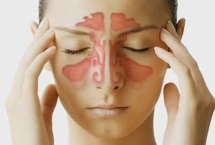 Viêm xoang là căn bệnh gây ra nhiều triệu chứng khó chịu, mệt mỏi.