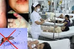 Bệnh tay chân miệng, sốt xuất huyết dễ "tấn công" trẻ trong tháng 8