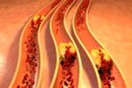 Những biện pháp tự nhiên để giảm mức cholesterol