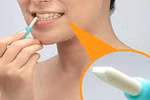 Bút tẩy trắng răng dễ gây viêm lợi