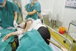 Chuyện khó tin: Ngã phải cọc dài 1,3 m xuyên dọc người vẫn sống sót