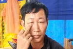 Dân say rượu bị Trưởng công an xã xịt hơi cay vào mặt