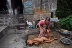 Những bức hình ám ảnh mang tên nỗi đau chất độc màu da cam