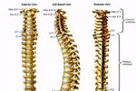 Các loại ung thư di căn xương