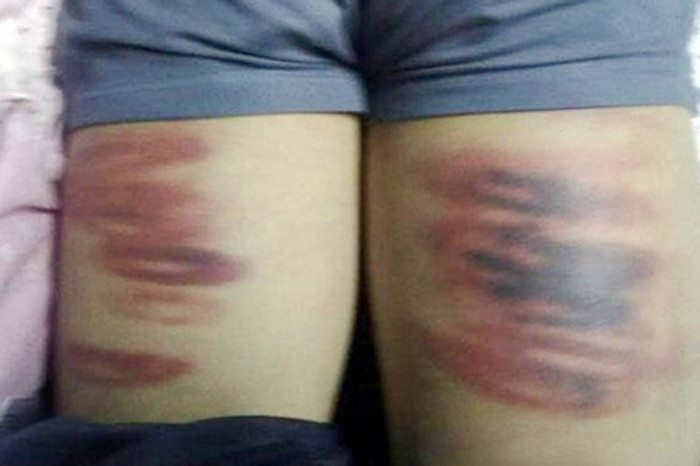 Không hiểu khi nhìn thấy con em mình bị trừng phạt theo kiểu này,các bậc phụ huynh sẽ nghĩ thế nào? >> RỚT NƯỚC MẮT VÌ ƯỚC MUỐN GIẢN DỊ CỦA NHỮNG ĐỨA TRẺ BỊ ĐÒN ROI >> NHỮNG TRÒ QUÁI CHIÊU CỦA SINH VIÊN TRUNG QUỐC Không hiểu khi nhìn thấy con em mình bị trừng phạt theo kiểu này,các bậc phụ huynh sẽ nghĩ thế nào? >> RỚT NƯỚC MẮT VÌ ƯỚC MUỐN GIẢN DỊ CỦA NHỮNG ĐỨA TRẺ BỊ ĐÒN ROI >> NHỮNG TRÒ QUÁI CHIÊU CỦA SINH VIÊN TRUNG QUỐC