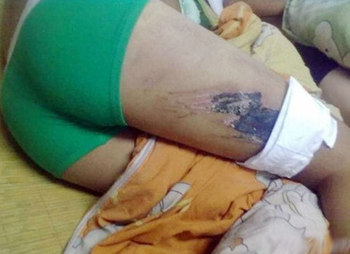 Mặc dù mỗi trường có những cách rèn luyện và giáo dục học sinh theo cách của mình nhưng việc đánh đập dã man, để lại những vết thương, vết sẹo không biết bao giờ lành thế này thực sự khiến người ta phải xót xa. >> RỚT NƯỚC MẮT VÌ ƯỚC MUỐN GIẢN DỊ CỦA NHỮNG ĐỨA TRẺ BỊ ĐÒN ROI >> NHỮNG TRÒ QUÁI CHIÊU CỦA SINH VIÊN TRUNG QUỐC Mặc dù mỗi trường có những cách rèn luyện và giáo dục học sinh theo cách của mình nhưng việc đánh đập dã man, để lại những vết thương, vết sẹo không biết bao giờ lành thế này thực sự khiến người ta phải xót xa. >> RỚT NƯỚC MẮT VÌ ƯỚC MUỐN GIẢN DỊ CỦA NHỮNG ĐỨA TRẺ BỊ ĐÒN ROI >> NHỮNG TRÒ QUÁI CHIÊU CỦA SINH VIÊN TRUNG QUỐC