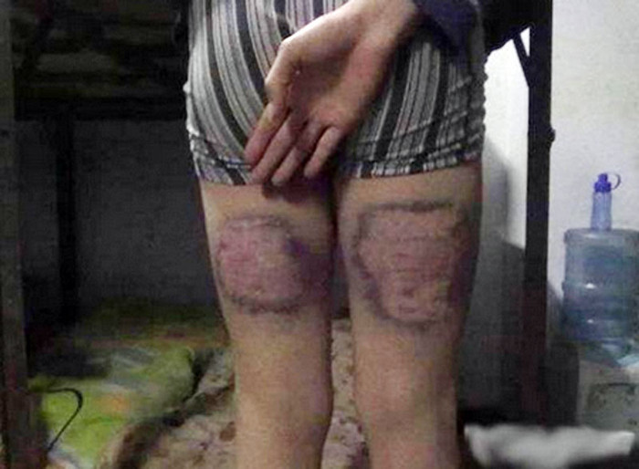 Tạo thành những "dấu tích" đáng ghê sợ theo suốt cả cuộc đời. >> RỚT NƯỚC MẮT VÌ ƯỚC MUỐN GIẢN DỊ CỦA NHỮNG ĐỨA TRẺ BỊ ĐÒN ROI >> NHỮNG TRÒ QUÁI CHIÊU CỦA SINH VIÊN TRUNG QUỐC Tạo thành những "dấu tích" đáng ghê sợ theo suốt cả cuộc đời. >> RỚT NƯỚC MẮT VÌ ƯỚC MUỐN GIẢN DỊ CỦA NHỮNG ĐỨA TRẺ BỊ ĐÒN ROI >> NHỮNG TRÒ QUÁI CHIÊU CỦA SINH VIÊN TRUNG QUỐC