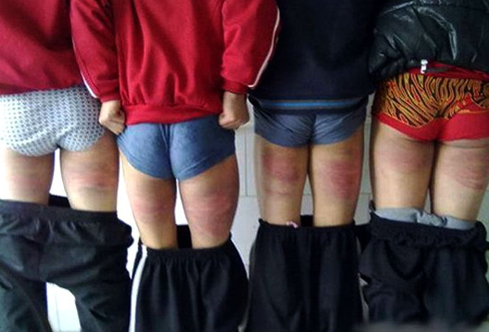 Theo các bạn học sinh trong trường, những bạn bị đánh là do đã vi phạm vào các quy định như nói chuyện trong giờ, sử dụng điện thoại di động, hút thuốc, đến muộn... >> RỚT NƯỚC MẮT VÌ ƯỚC MUỐN GIẢN DỊ CỦA NHỮNG ĐỨA TRẺ BỊ ĐÒN ROI >> NHỮNG TRÒ QUÁI CHIÊU CỦA SINH VIÊN TRUNG QUỐC Theo các bạn học sinh trong trường, những bạn bị đánh là do đã vi phạm vào các quy định như nói chuyện trong giờ, sử dụng điện thoại di động, hút thuốc, đến muộn... >> RỚT NƯỚC MẮT VÌ ƯỚC MUỐN GIẢN DỊ CỦA NHỮNG ĐỨA TRẺ BỊ ĐÒN ROI >> NHỮNG TRÒ QUÁI CHIÊU CỦA SINH VIÊN TRUNG QUỐC