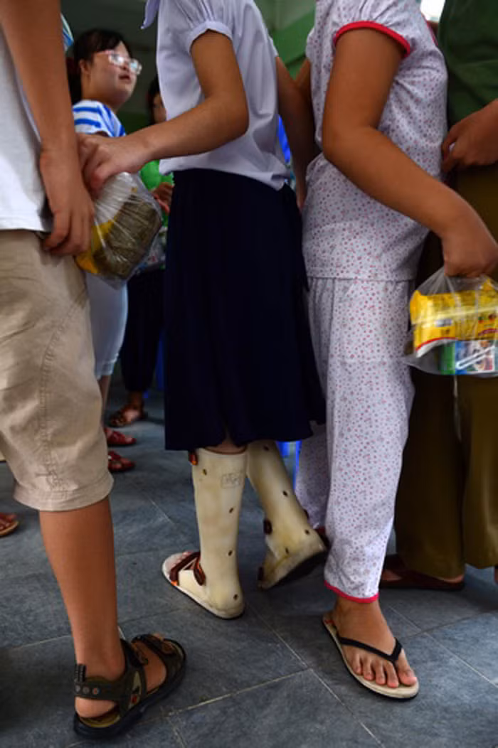 Cũng quần áo tinh tơm tới dự khai giảng, chỉ có điều em nhỏ này không may mắn để có đôi chân khỏe mạnh như các bạn. >>Những hình ảnh đẹp nhất lễ khai giảng 2012 >>Xúc động hình ảnh chú lính chì Thiện Nhân vào lớp 1 >>Những hình ảnh ấn tượng Lễ tốt nghiệp HV Cảnh sát Nhân dân