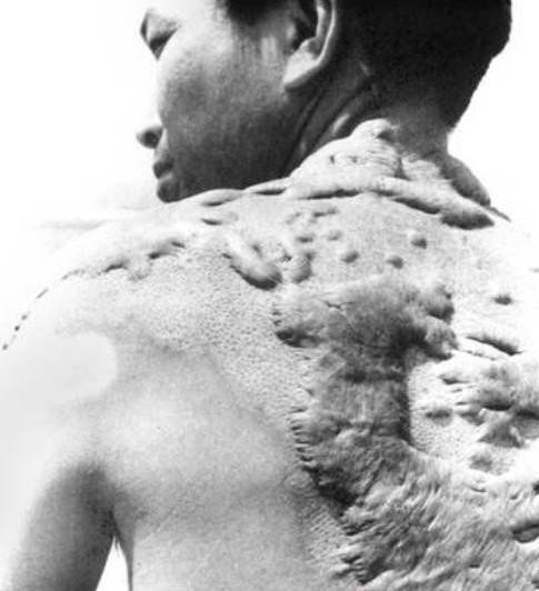 Thảm họa hạt nhân Thảm họa hạt nhân