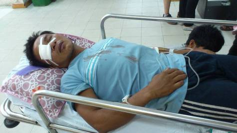 Anh Lê Văn Dũng bị nhóm đối tượng tấn công bằng súng khi đang đánh bắt trên biển làm anh bị thương nặng Anh Lê Văn Dũng bị nhóm đối tượng tấn công bằng súng khi đang đánh bắt trên biển làm anh bị thương nặng