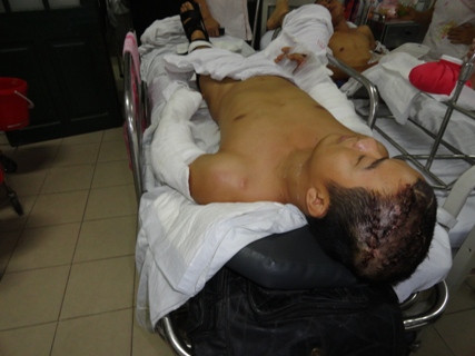 Anh Điền đang điều trị tại Bệnh viện Việt Đức, Hà Nội với đa chấn thương sau khi lãnh trận mưa dao của nhóm côn đồ Anh Điền đang điều trị tại Bệnh viện Việt Đức, Hà Nội với đa chấn thương sau khi lãnh trận mưa dao của nhóm côn đồ