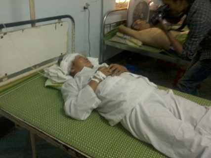 Vụ nổ làm ông Hà bị mất một cánh tay và bị chấn thương nặng khắp người Vụ nổ làm ông Hà bị mất một cánh tay và bị chấn thương nặng khắp người