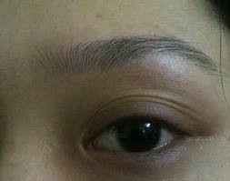 Mắt bị lồi: Nguyên nhân thông thường nhất của chứng mắt lồi là bệnh cường năng tuyến giáp. Tuy nhiên, một vài người di truyền chứng mắt lồi. Đối với những người như vậy, mắt lồi có thể không phải là một triệu chứng của bệnh. Xem thêm: Móng tay... nói lên bệnh tật: tim, gan, phổi Mắt bị lồi: Nguyên nhân thông thường nhất của chứng mắt lồi là bệnh cường năng tuyến giáp. Tuy nhiên, một vài người di truyền chứng mắt lồi. Đối với những người như vậy, mắt lồi có thể không phải là một triệu chứng của bệnh. Xem thêm: Móng tay... nói lên bệnh tật: tim, gan, phổi