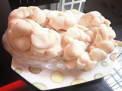 Dùng mỡ trăn hoặc dầu cá: Nhiều lọ mỡ trăn không được tiệt trùng nên hầu hết bị ôi thiu do nhiễm vi sinh vật. Do đó, vết bỏng bị nhiễm khuẩn rất nhanh. Còn dầu cá có mùi tanh, khi bôi lên sẽ bị hôi tanh và gọi ruồi đến. Xem thêm:26 loại thực phẩm giúp bạn ‘thanh lọc’ cơ thể Dùng mỡ trăn hoặc dầu cá: Nhiều lọ mỡ trăn không được tiệt trùng nên hầu hết bị ôi thiu do nhiễm vi sinh vật. Do đó, vết bỏng bị nhiễm khuẩn rất nhanh. Còn dầu cá có mùi tanh, khi bôi lên sẽ bị hôi tanh và gọi ruồi đến. Xem thêm:26 loại thực phẩm giúp bạn ‘thanh lọc’ cơ thể