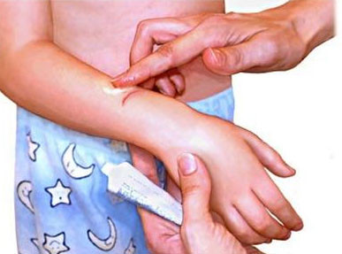 Trong trường hợp bỏng axít, người ta dùng kem đánh răng để rửa và trung hoà axít còn dư lại. Khi bị bỏng axít, bạn phải hoà loãng nồng độ axít còn lại trên da bằng cách ngâm ngay vào nước lạnh. Sau đó, trung hoà axít còn dư trên da bằng xà phòng hoặc kem đánh răng, bằng cách xoa nhẹ xà phòng hoặc kem đánh răng cho sủi bọt và ngấm sâu vào da rồi rửa sạch. Xem thêm:26 loại thực phẩm giúp bạn ‘thanh lọc’ cơ thể Trong trường hợp bỏng axít, người ta dùng kem đánh răng để rửa và trung hoà axít còn dư lại. Khi bị bỏng axít, bạn phải hoà loãng nồng độ axít còn lại trên da bằng cách ngâm ngay vào nước lạnh. Sau đó, trung hoà axít còn dư trên da bằng xà phòng hoặc kem đánh răng, bằng cách xoa nhẹ xà phòng hoặc kem đánh răng cho sủi bọt và ngấm sâu vào da rồi rửa sạch. Xem thêm:26 loại thực phẩm giúp bạn ‘thanh lọc’ cơ thể