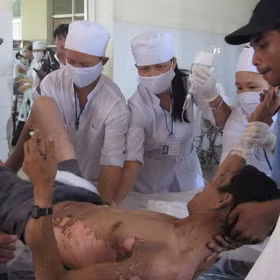 Vết bỏng độ 2: Nơi da bị bỏng sẽ có màu đỏ và rát. Đồng thời, những vết phồng rộp nổi lên trên da và có nước bên trong. Tùy vào vị trí bị bỏng mà có thể cẩn thận chăm sóc cho vết bỏng. Ở mức độ này với một chút thuốc men thích hợp và có thể cần đến sự trợ giúp của bác sĩ nếu có dấu hiệu báo động đỏ. Xem thêm:26 loại thực phẩm giúp bạn ‘thanh lọc’ cơ thể Vết bỏng độ 2: Nơi da bị bỏng sẽ có màu đỏ và rát. Đồng thời, những vết phồng rộp nổi lên trên da và có nước bên trong. Tùy vào vị trí bị bỏng mà có thể cẩn thận chăm sóc cho vết bỏng. Ở mức độ này với một chút thuốc men thích hợp và có thể cần đến sự trợ giúp của bác sĩ nếu có dấu hiệu báo động đỏ. Xem thêm:26 loại thực phẩm giúp bạn ‘thanh lọc’ cơ thể