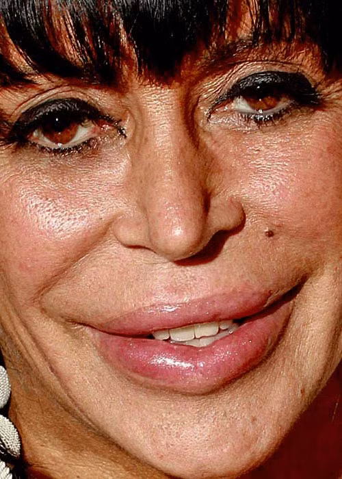 Angela Raiola khi nhìn cận cảnh có thể thấy từng lỗ chân lông và nốt ruồi ở trên gương mặt Xem thêm:Cận cảnh: mặc mộc xinh xắn của Katy Perry