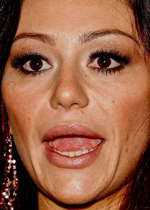 Enni Jwoww Farley với những dấu hiệu xuống sắc thể hiện trên khuôn mặt Xem thêm:Cận cảnh: mặc mộc xinh xắn của Katy Perry Enni Jwoww Farley với những dấu hiệu xuống sắc thể hiện trên khuôn mặt Xem thêm:Cận cảnh: mặc mộc xinh xắn của Katy Perry