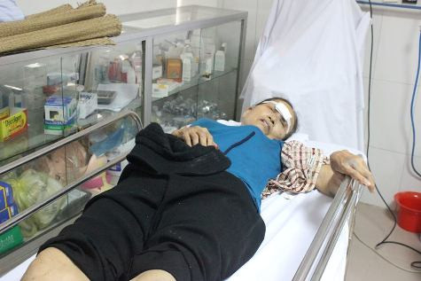 Đã có 20 hành khách trên xe khách bị đa chấn thương phải đưa vào Bệnh viện 115 Nghệ Ancấp cứu Đã có 20 hành khách trên xe khách bị đa chấn thương phải đưa vào Bệnh viện 115 Nghệ Ancấp cứu