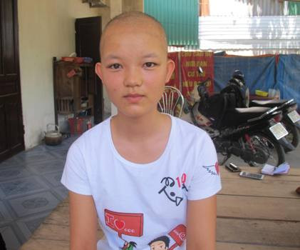 Mắc phải căn bệnh lạ cách đây 7 năm nên tóc của Nhi đã bị rụng hết