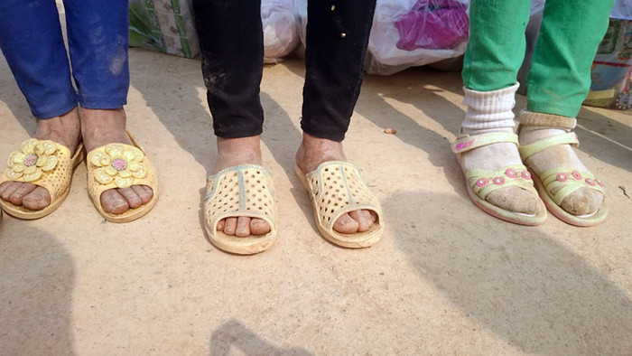 Mùa đông đến, nhiều em vẫn chưa được mặc ấm. Bàn chân các em nứt nẻ khi hàng ngày đến trường với đôi dép lê.