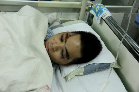 Mạnh đang dần bình phục.Ảnh Xuân Trung Mạnh đang dần bình phục.Ảnh Xuân Trung