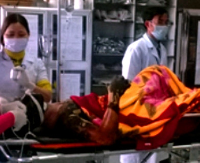 Anh H nhập viện trong tình trạng bỏng nặng toàn thân Anh H nhập viện trong tình trạng bỏng nặng toàn thân