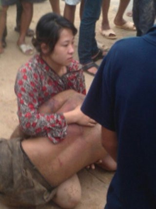 Đến bao giờ cái cảnh đổi mạng người lấy mạng chó mới kết thúc? Đến bao giờ cái cảnh đổi mạng người lấy mạng chó mới kết thúc?