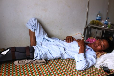 Anh Nam đang nằm điều trị sau khi bị vị phó công an xã đánh gãy xương