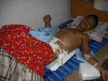 Anh Cường đang điều trị tạo bệnh viện đa khoa tỉnh Nghệ An