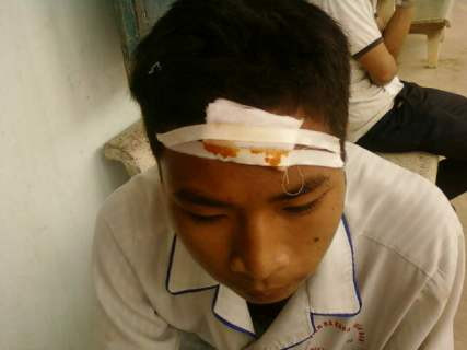 Anh Nguyễn Văn Hiệp (con trai ông Nam) với vết tương bị chém trên trán đang điều trị tại Bệnh viện Đa khoa Nghĩa Đàn