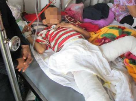 Mặc dù đang đau vì vết bỏng do chính cha mình gây ra nhưng cháu V. vẫn lo lắng và sợ cha mình bi bắt chỉ vì mình.