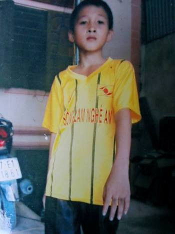 Cháu Hạnh với các vết bầm ở bàn tay sau khi bị công an viên xã Thanh Tùng dùng bút kẹp bắt nhận tội bắt chim (ảnh do gia đình cung cấp) Cháu Hạnh với các vết bầm ở bàn tay sau khi bị công an viên xã Thanh Tùng dùng bút kẹp bắt nhận tội bắt chim (ảnh do gia đình cung cấp)