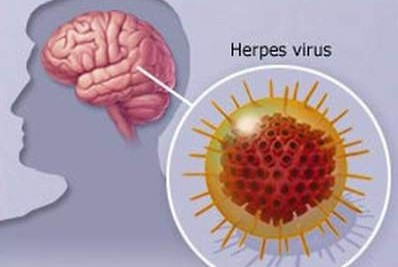 Bệnh này thường gặp ở con người và ngựa