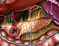 4. Ung thư tụy: Ung thư tụy bắt đầu từ mô tụy – nơi trợ giúp tiêu hóa và điều hòa chuyển hóa. Theo Bệnh viện Mayo Clinic, phát hiện và can thiệp sớm là rất khó vì bệnh thường tiến triển âm thầm và nhanh. NCI cho biết năm 2010 có 37.000 người tử vong do ung thư tụy.