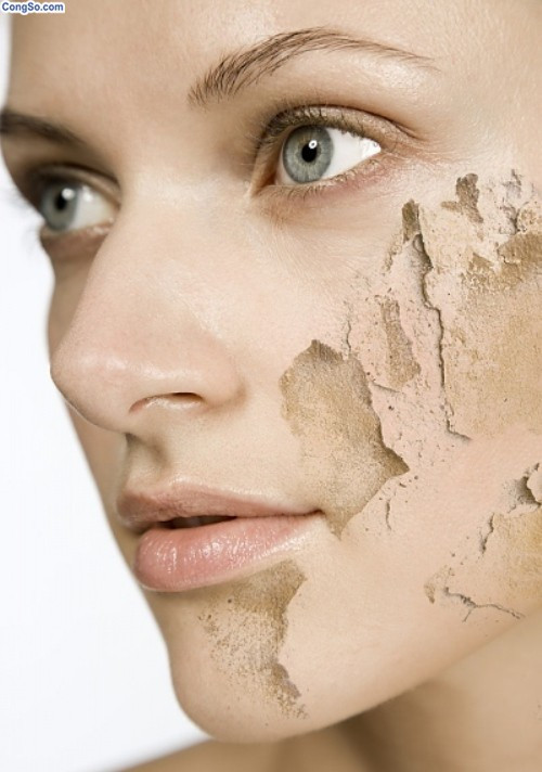 Mụn, da lở loét và ngứa ngáy, lở loét tại các vết thương mở , vết bỏng …đều là những triệu chứng của bệnh ung thư da.