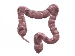 Máu lẫn trong phân, kèm theo tiêu chảy hoặc táo bón, trong phân có dịch nhầy là những triệu chứng của bệnh ung thư hệ thống tiêu hóa, đặc biệt là ung thư ruột già và ung thư trực tràng.