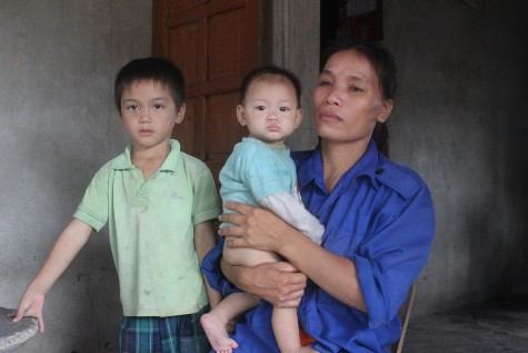 Chị Nhung rất hối hận vì đã lỡ tay đẩy con trai mình vào đống lửa khiến cháu bị bỏng nặng Chị Nhung rất hối hận vì đã lỡ tay đẩy con trai mình vào đống lửa khiến cháu bị bỏng nặng