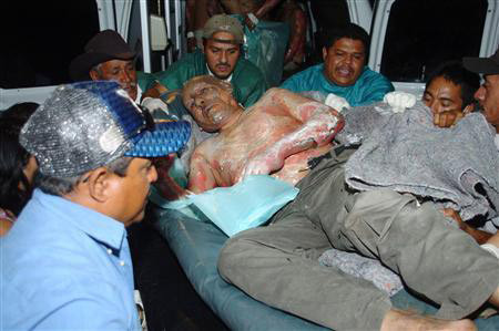 Một phạm nhân bị bỏng nặng được đưa khỏi hiện trường.