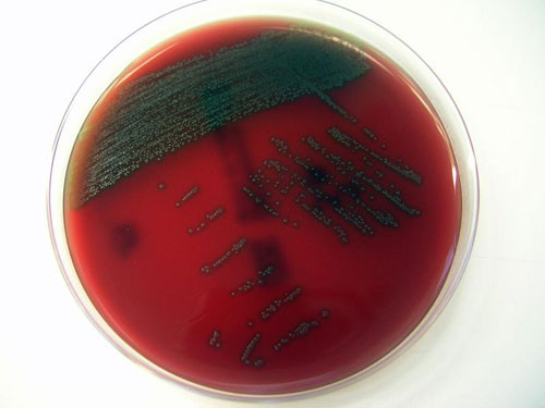 Vi khuẩn Streptococcus Tigurinus - Ảnh: IDW-online Vi khuẩn Streptococcus Tigurinus - Ảnh: IDW-online